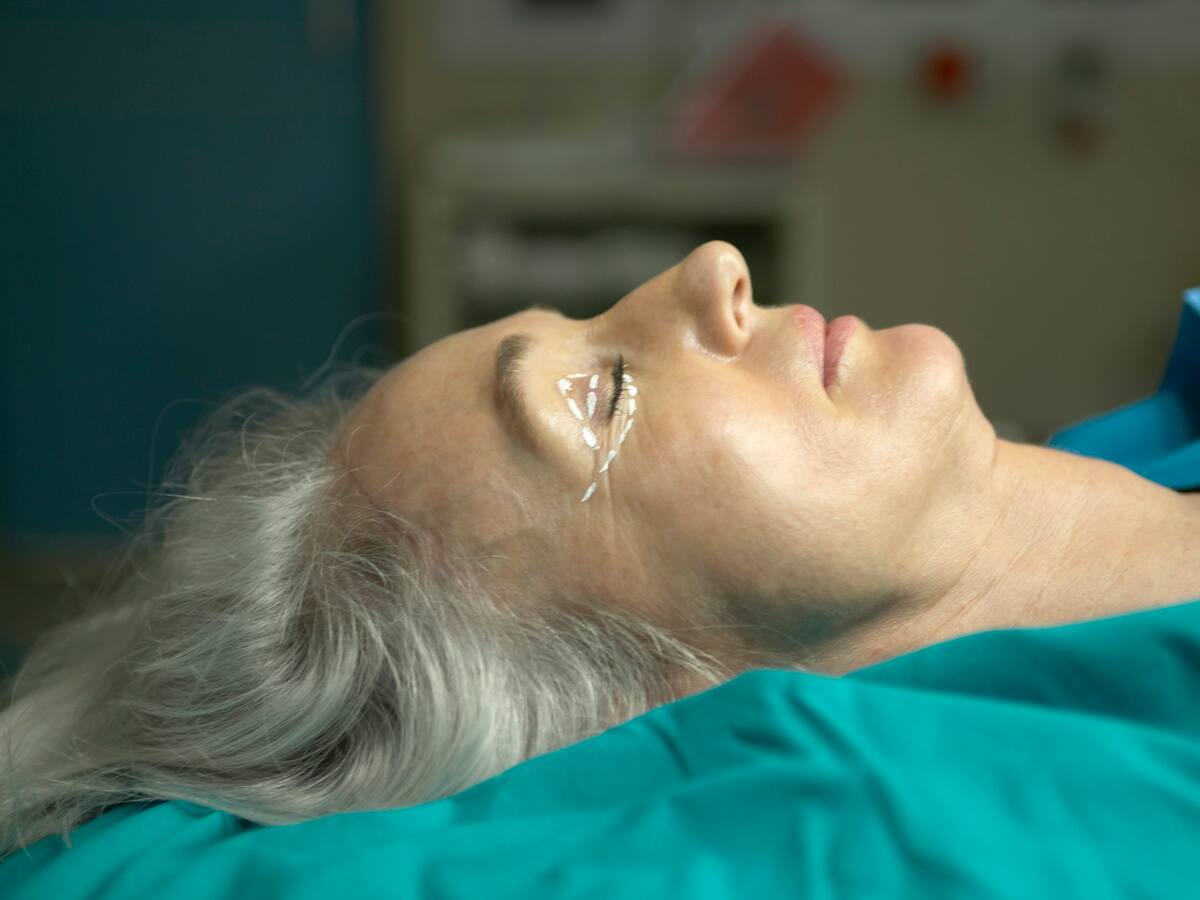 ABC de la blefaroplastia: así es la cirugía de los párpados explicada por experto