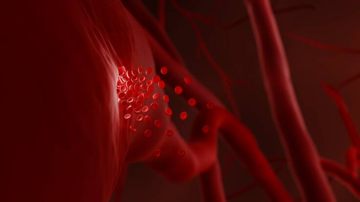 ¿Cómo detectar la hemofilia y otros trastornos de la coagulación de la sangre?