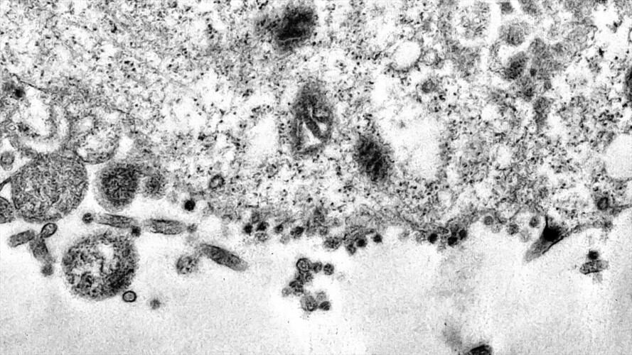 Científicos de Brasil capturan el momento de contagio con la COVID-19. . Foto: Captura de pantalla