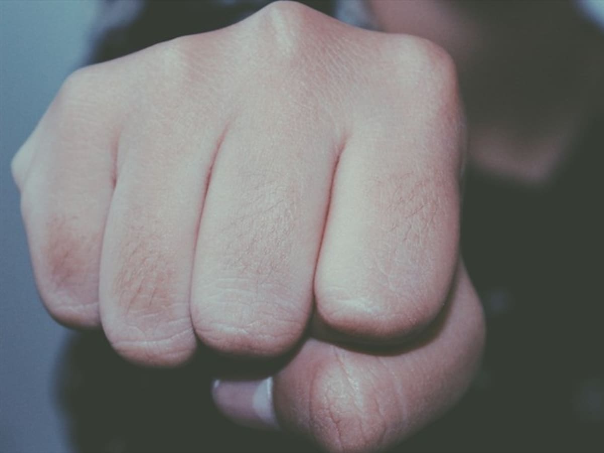 Nieto le propinó una brutal golpiza a su abuela porque se comió sus papas fritas