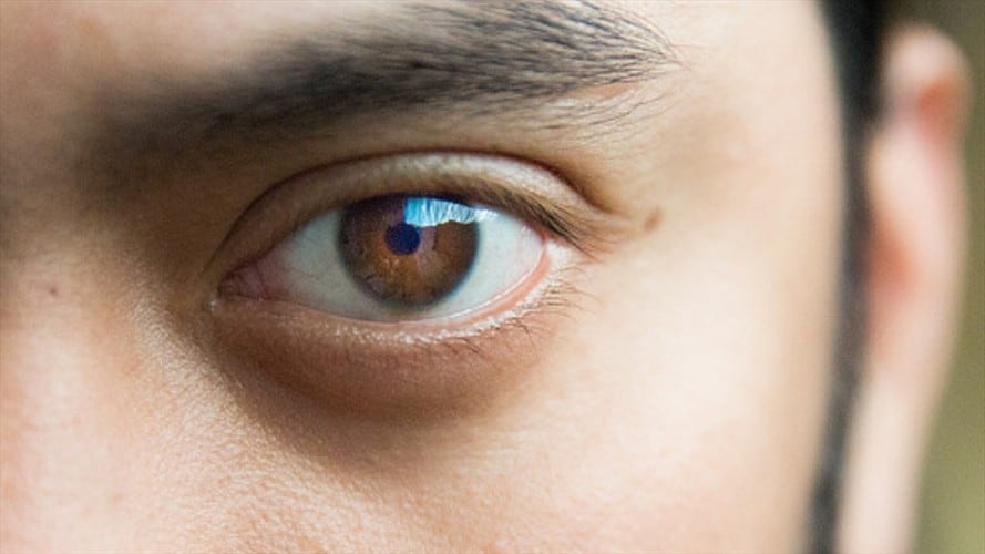 Se estima que cerca del 30% de los colombianos pueden sufrir del síndrome.. Foto: Getty Images