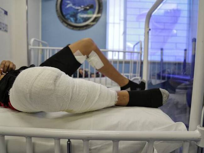 Quemado con pólvora en Tunja.