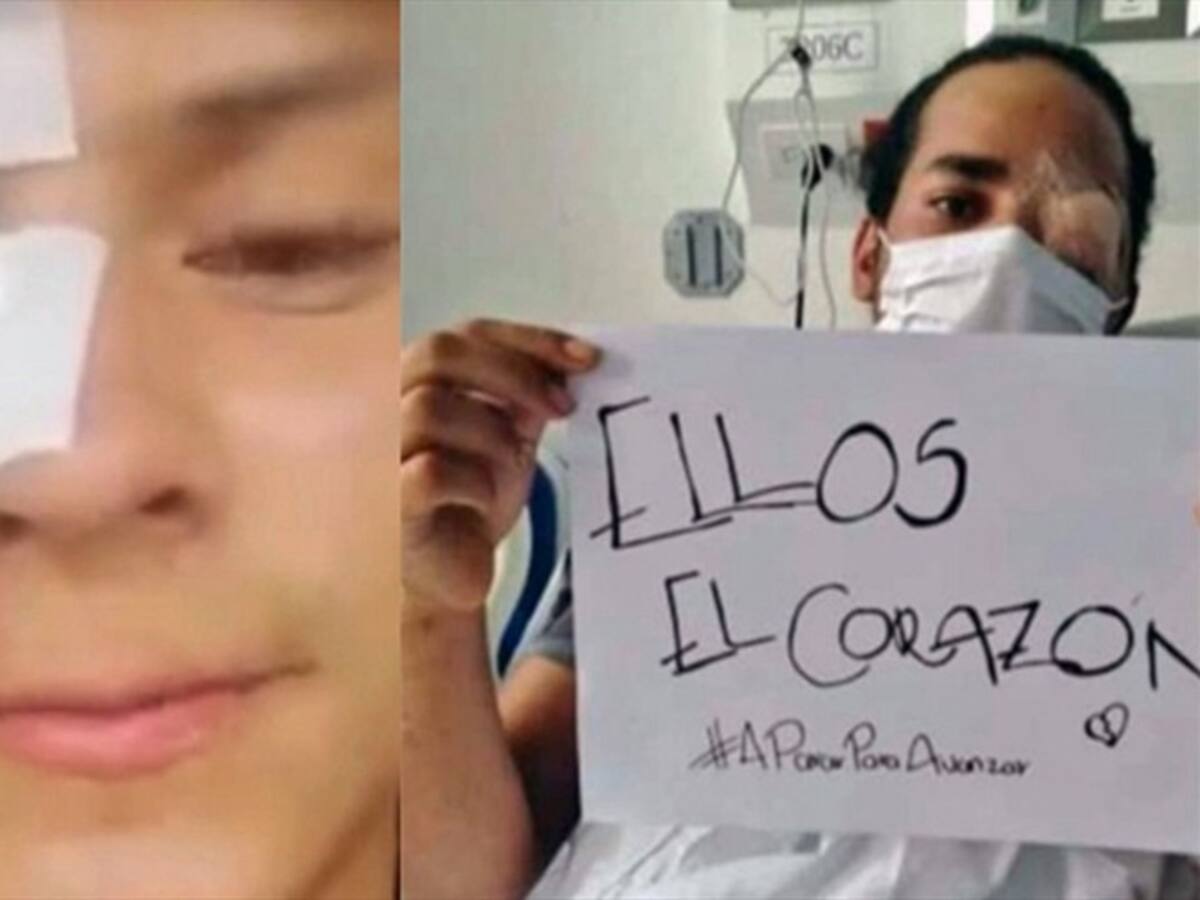 La historia de los dos jóvenes heridos en sus ojos por el Esmad en Popayán