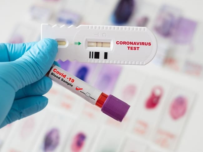 ¿En qué ocasiones deben practicarse las pruebas rápidas de COVID-19?