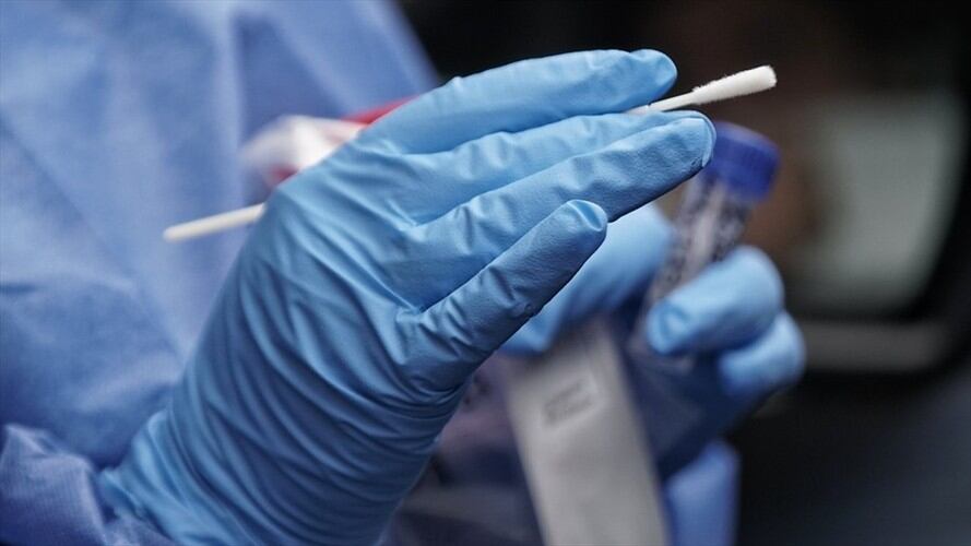 Pruebas coronavirus. Foto: Colprensa