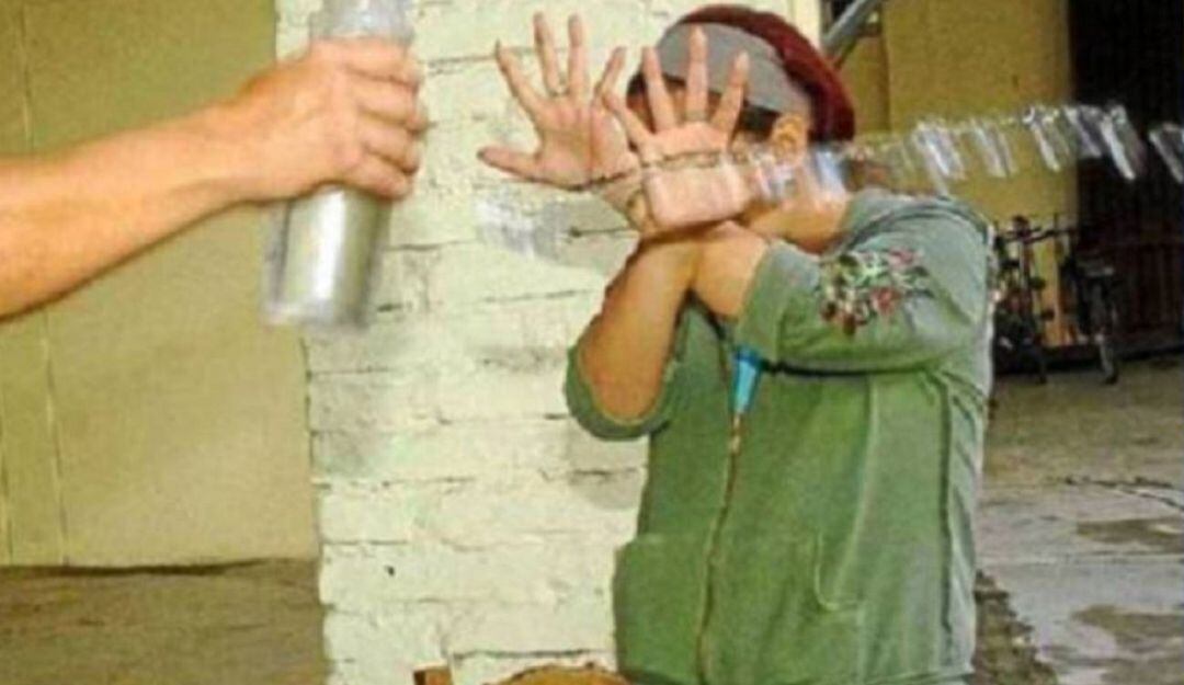 Ataque con ácido en Tunja. Foto: Colprensa.