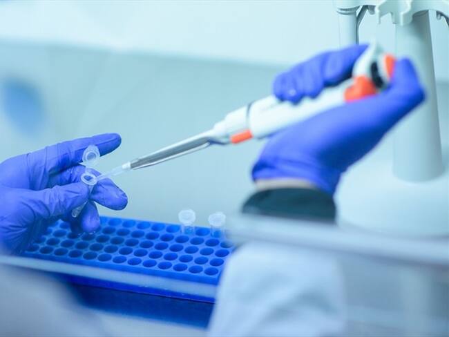 Imagen de referencia de análisis en laboratorio.. Foto: Getty Images / CMB.