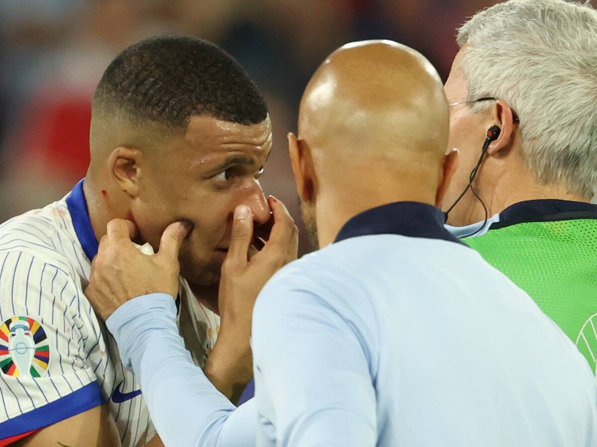 Video: así fue el duro golpe de Mbappé en partido contra Austria por Eurocopa