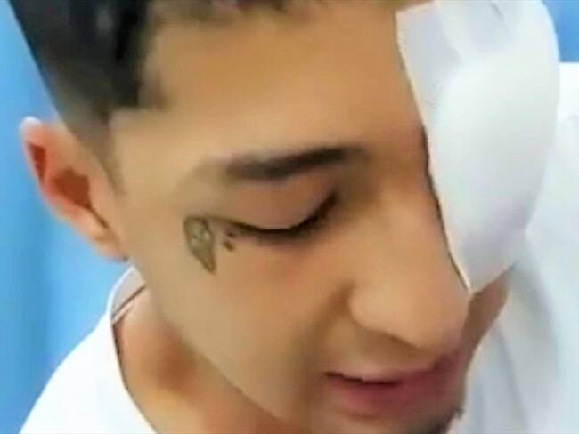 Faber Camilo Carvajal, joven que resultó herido en los recientes enfrentamientos en la capital del Cauca . Foto: Cortesía