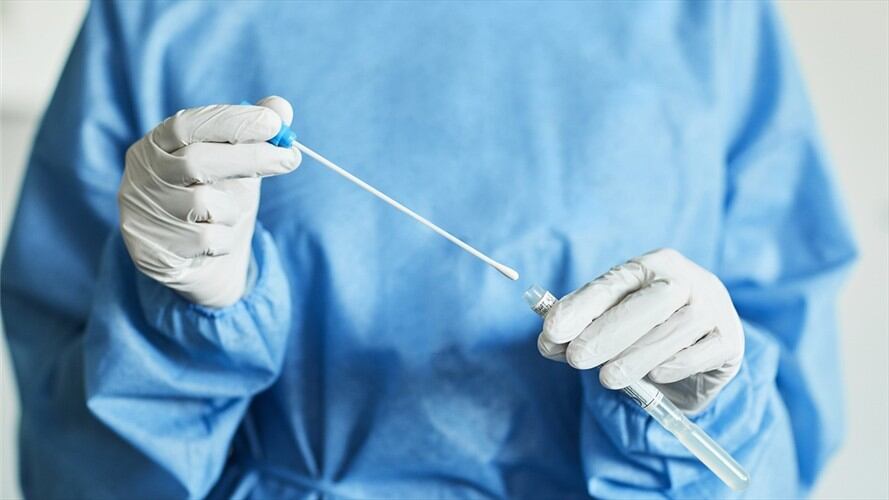 Imagen de referencia de prueba PRC para COVID-19. Foto: Getty Images / Morsa Images