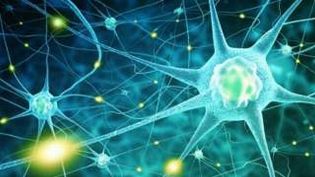 Una hemorragia cerebral suele causar el síndrome.. Foto: BBC Mundo
