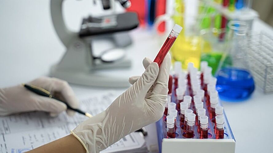 Médicos detectaron inconvenientes en la sangre de pacientes con COVID-19. Foto: Getty Images