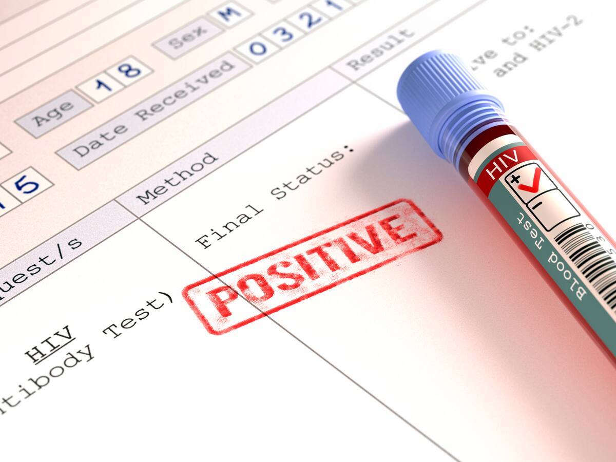 Hey Hey ¡Es Contigo!: la campaña del Gobierno para prevenir la infección del VIH