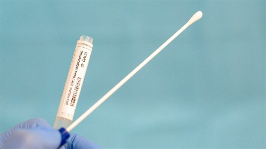 Foto de referencia de una prueba de coronavirus. Foto: Getty Images