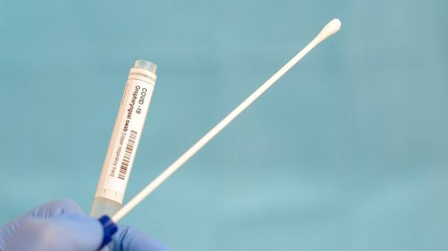 Foto de referencia de una prueba de coronavirus. Foto: Getty Images