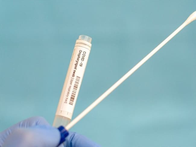 Foto de referencia de una prueba de coronavirus. Foto: Getty Images