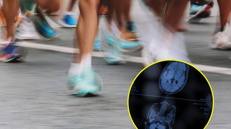 ¿Correr maratones es riesgoso para la salud del cerebro? Experto responde