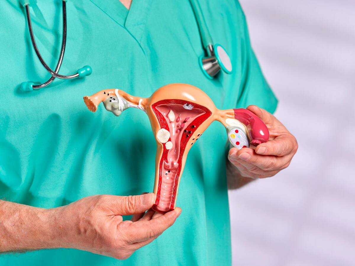 ¿Cómo evitar los gases vaginales? Sexólogo aclaró dudas, mitos y recomendaciones