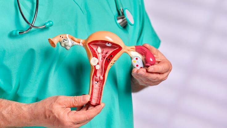 ¿Cómo evitar los gases vaginales? Sexólogo aclaró dudas, mitos y recomendaciones