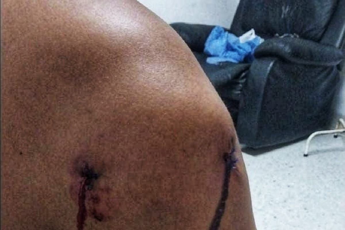 La víctima fue atendida en el hospital de Florida en el Valle del Cauca. Crédito, Cortesía. 