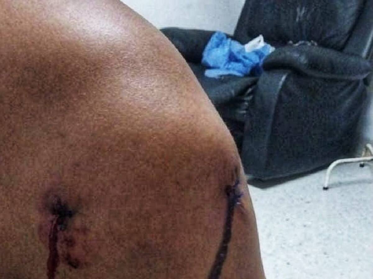 Atentaron contra un integrante del pueblo nasa en el norte del Cauca