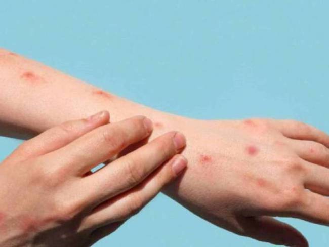 Archivo Caracol Radio