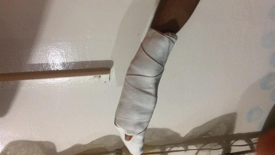 Cifras de lesionados con pólvora superaron las del año 2017.. Foto: Colprensa