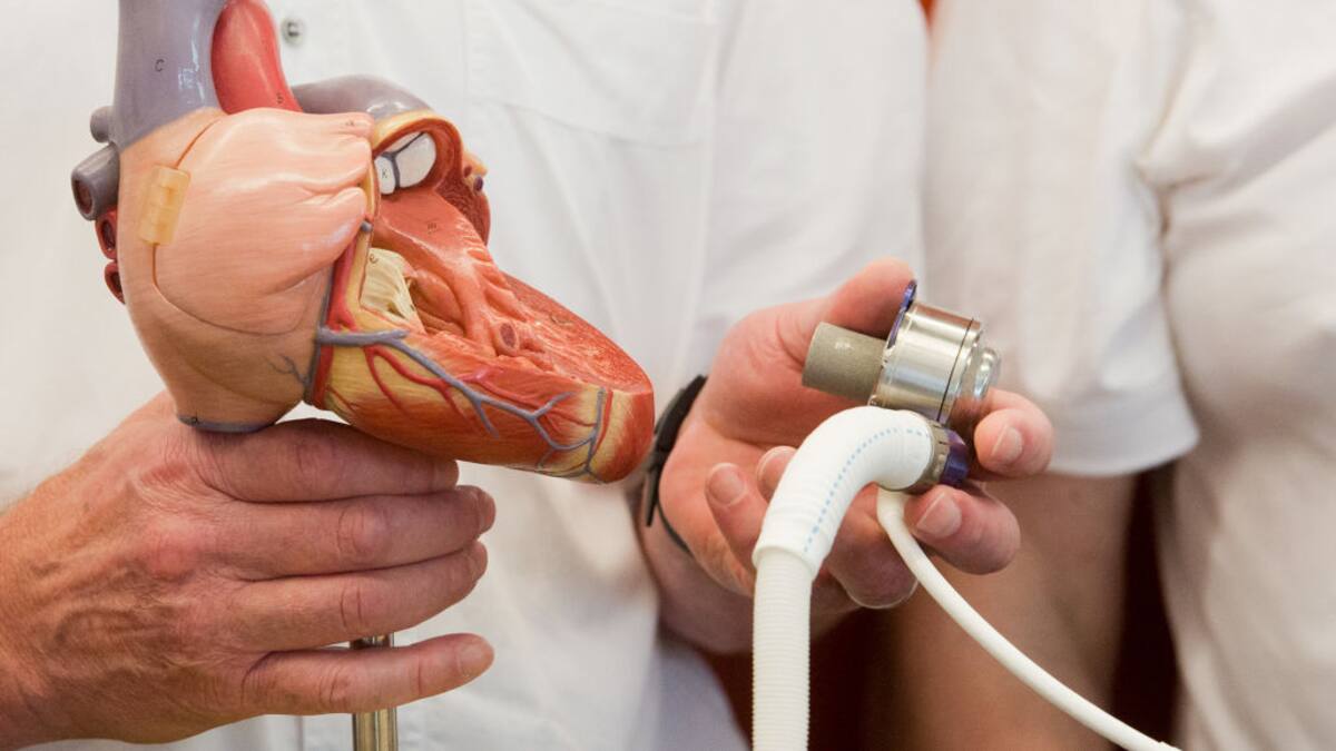 La primera mujer en implantar un corazón artificial en Latinoamérica es colombiana