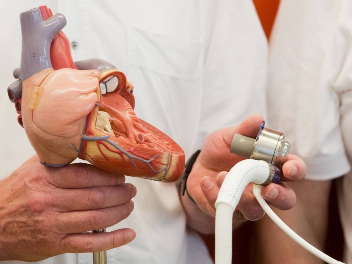 La primera mujer en implantar un corazón artificial en Latinoamérica es colombiana