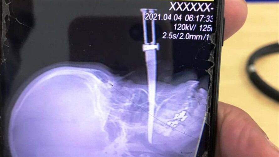 Hombre acuchilló a mujer en Cartagena. Foto: Cortesía Antonio Canchila