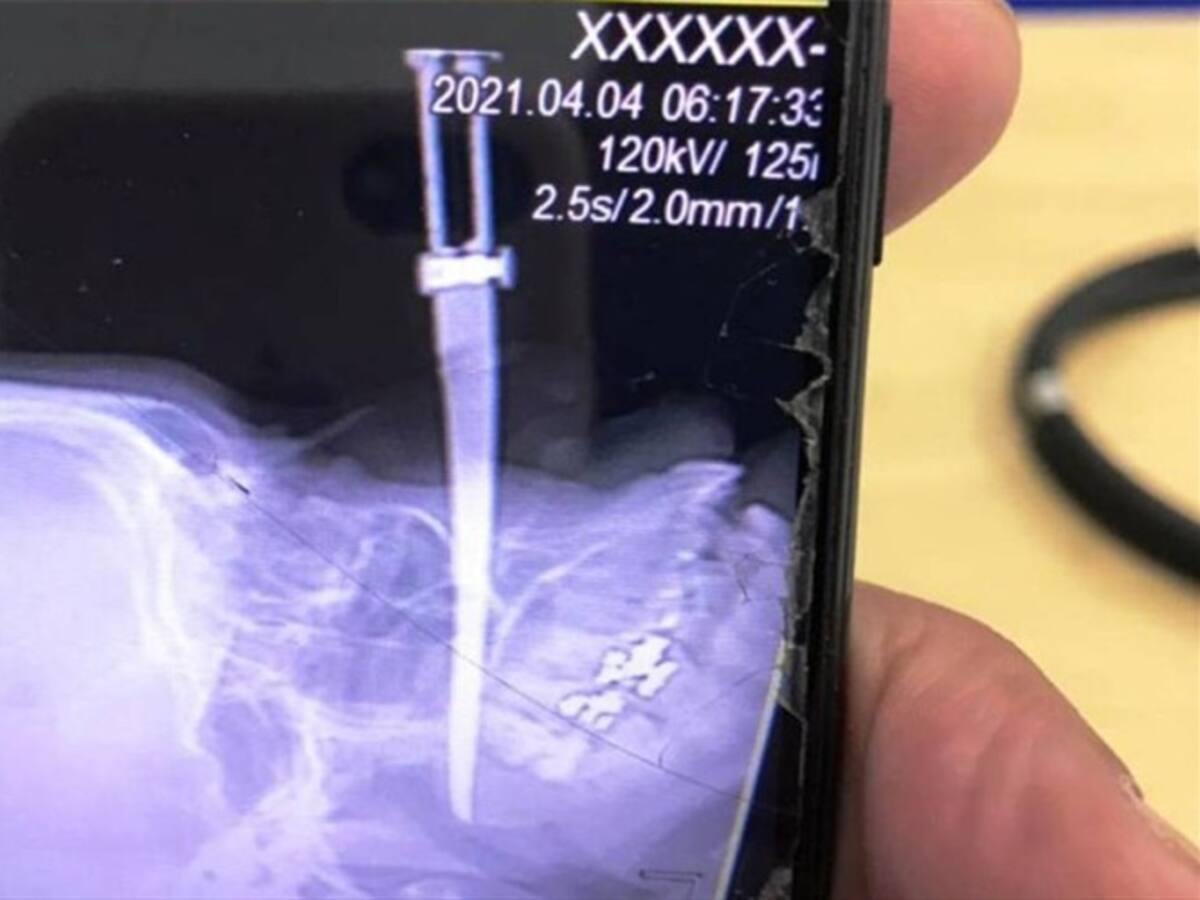 En Cartagena están tras la pista del hombre que acuchilló a una mujer en el rostro