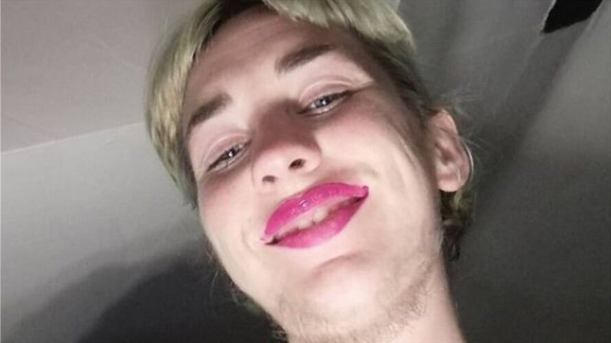 Bethany Burgoyne, la mujer que dejó de depilarse el cuerpo por 3 años. Foto: Instagram: @bxsassy