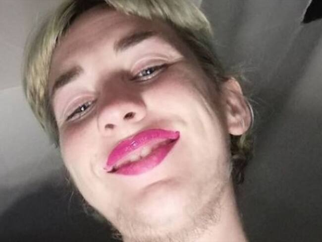 Bethany Burgoyne, la mujer que dejó de depilarse el cuerpo por 3 años. Foto: Instagram: @bxsassy