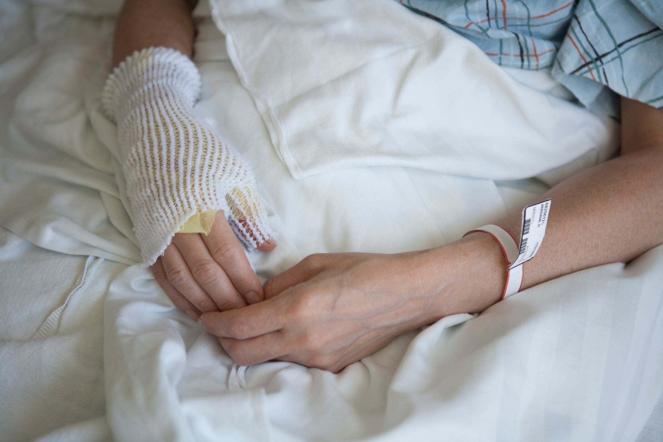 Quemados por pólvora, Imagen de Referencia. Foto: Getty Images