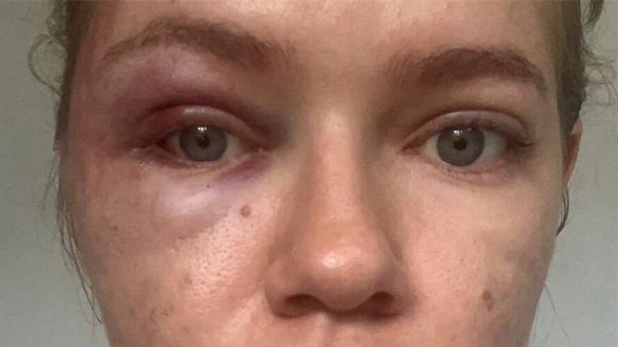 Denuncian a concejal por caso de violencia intrafamiliar en Ocaña. Foto: Cortesía : La imagen de publica con autorización de la víctima