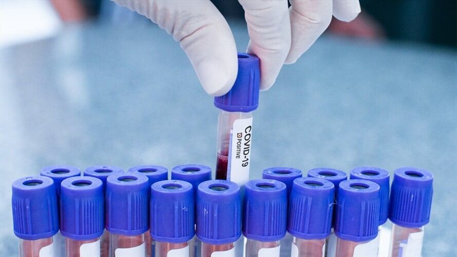 El estudio tendrá el apoyo de la Alcaldía de Cali, la Gobernación del Valle del Cauca y el DANE. Foto: Getty Images