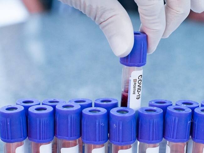 El estudio tendrá el apoyo de la Alcaldía de Cali, la Gobernación del Valle del Cauca y el DANE. Foto: Getty Images