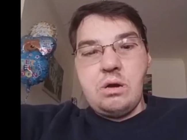 La historia del hombre con el primer trasplante de cara