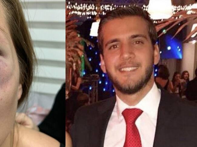 Denuncian que empresario caleño agredió a su pareja