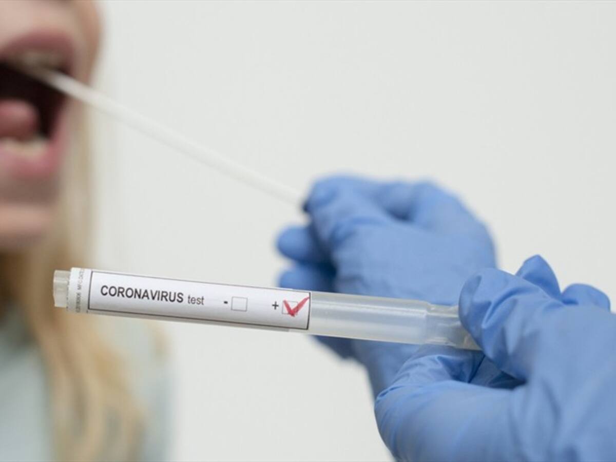 ¿Dónde y cómo puede hacerse una prueba de COVID-19 de manera particular?