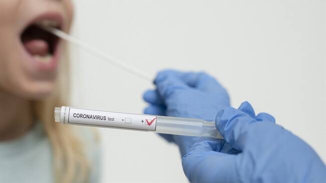 ¿Dónde y cómo puede hacerse una prueba de COVID-19 de manera particular?. Foto: Getty Images