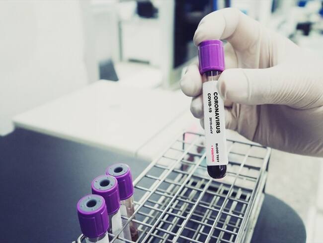 Casos de COVID-19 en Colombia. Foto: Getty Images