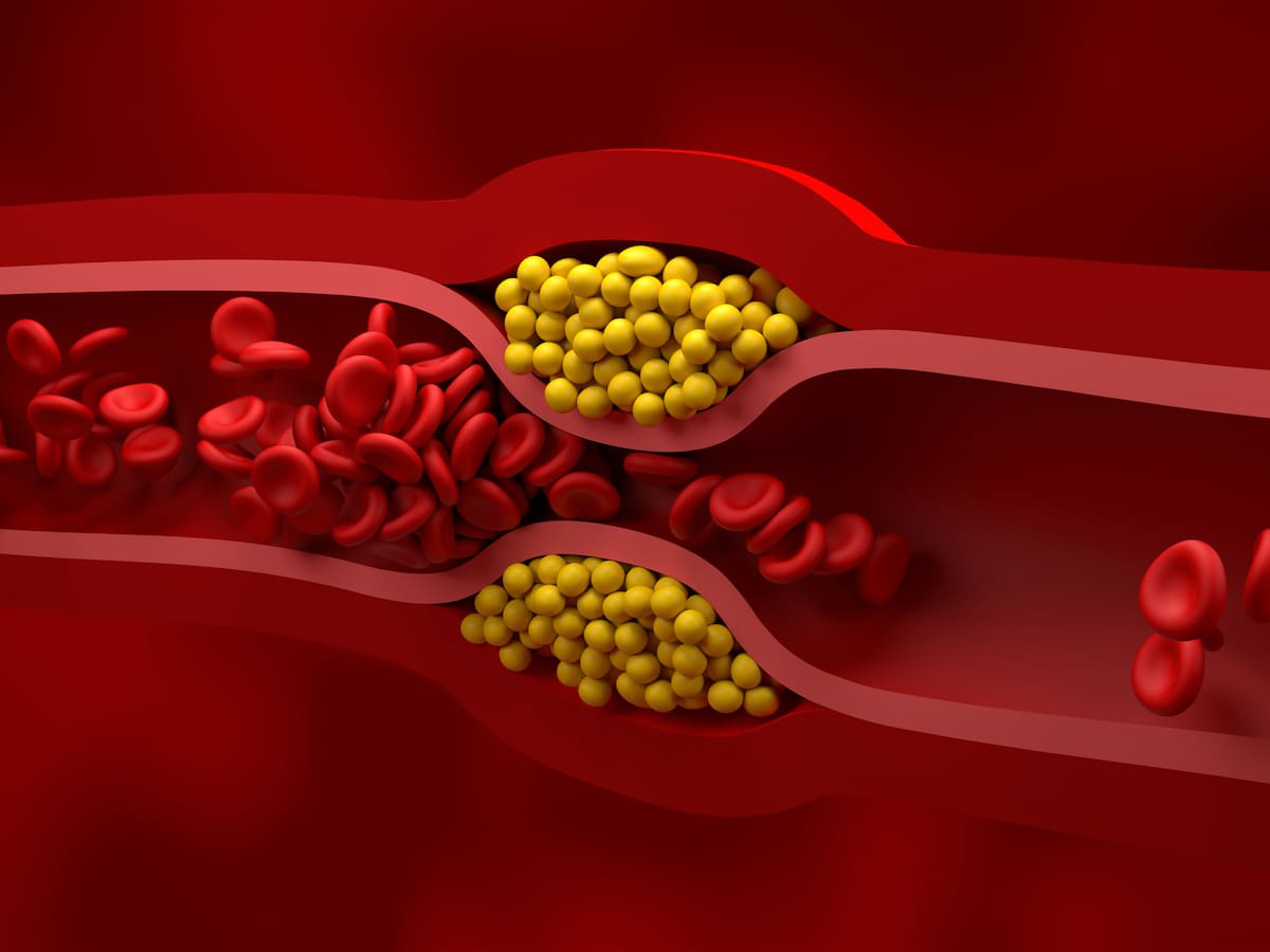 ¿El colesterol es bueno o malo?: Experta aclaró