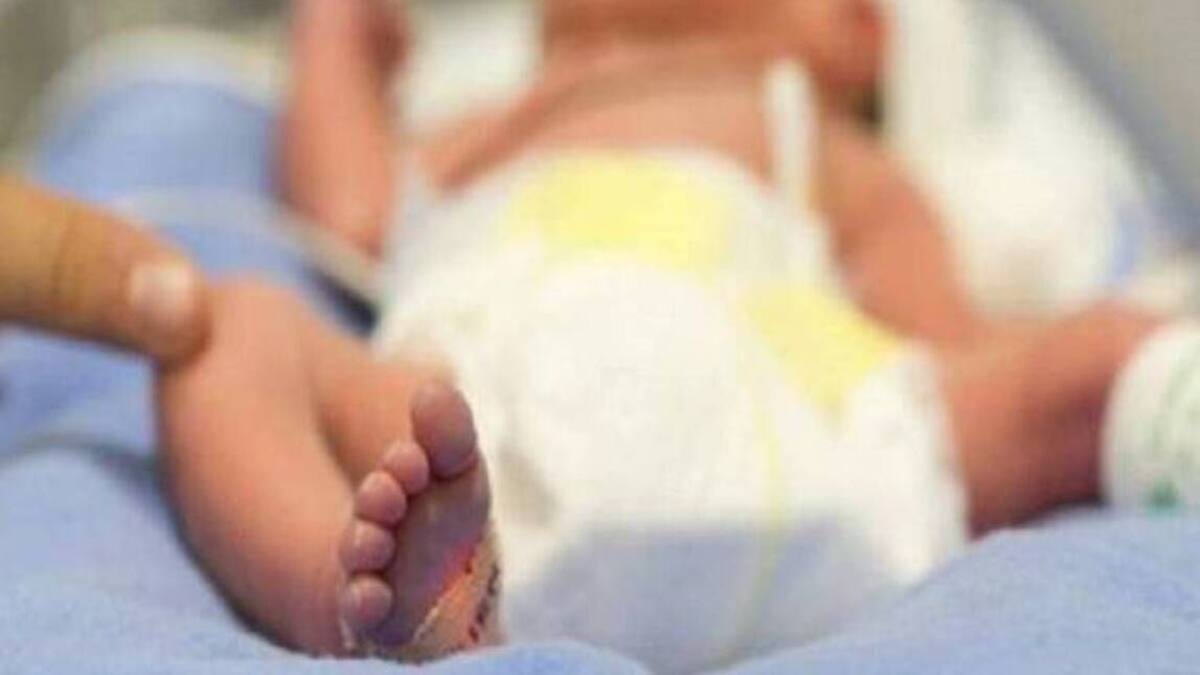 Bebé indígena de Risaralda en delicado estado de salud por ablación genital