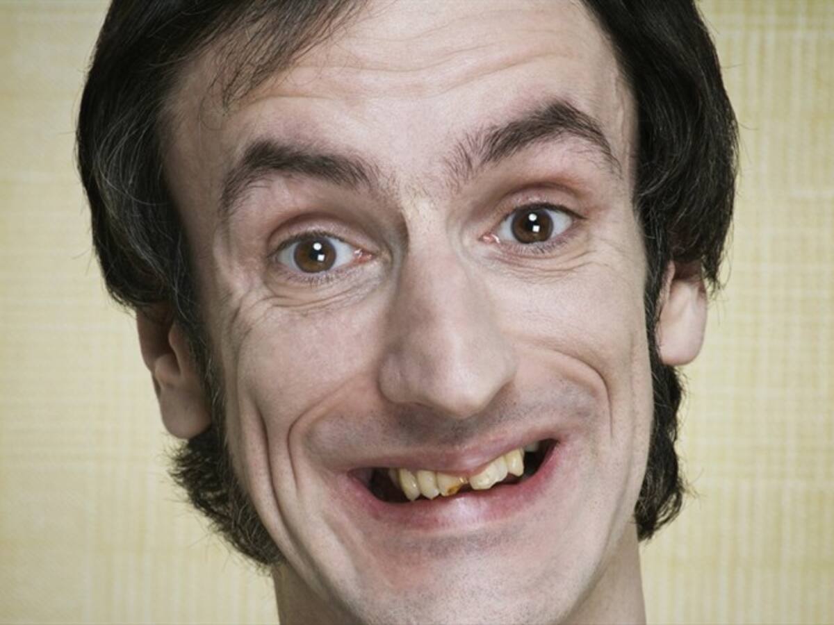 TOP 10: Di que eres feo sin decir que eres feo