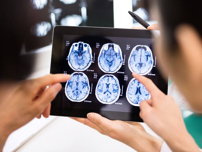 Cirugías cerebrales para tratar trastornos psiquiátricos: ¿cómo funcionan?