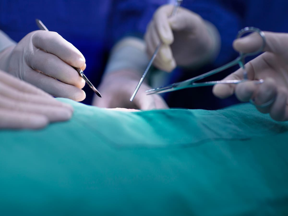 Murió paciente que recibió primer trasplante de riñón de cerdo genéticamente modificado