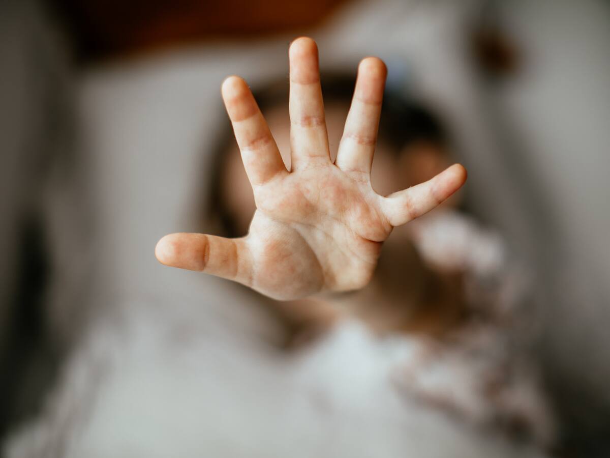 Denuncian aberrante caso de maltrato a una menor de edad por parte de su abuela en Envigado, Antioquia