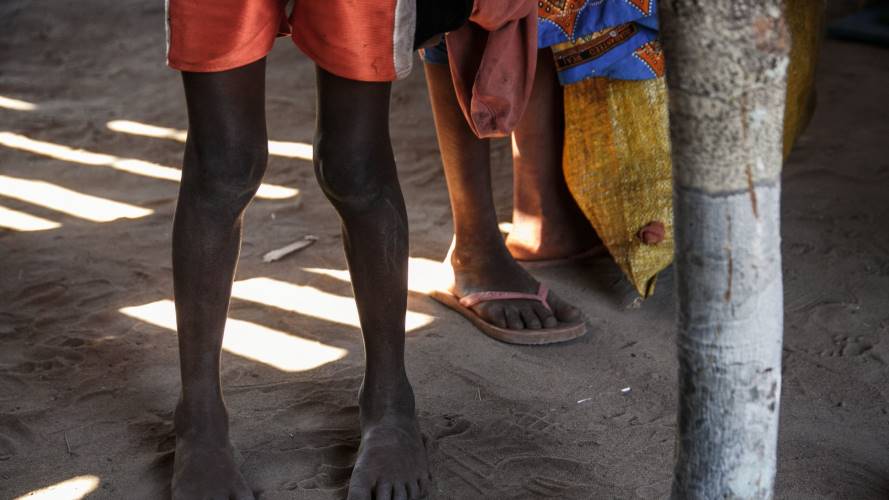 Desnutrición en niños. Créditos: Getty Images
