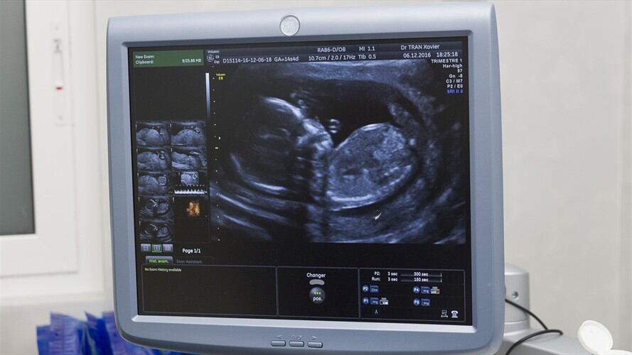 En octubre de 2018 se estableció que el derecho de las mujeres a abortar seguirá siendo el mismo al que existe desde hace 12 años en el país. Foto: Getty Images